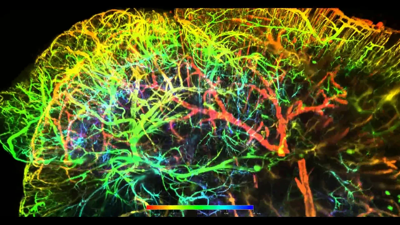 Light Sheet Microscopy Brain Shelly Lighting