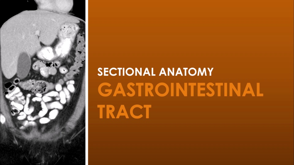 CT Gastrointestinal Tract | Video Lesson | Clover Learning