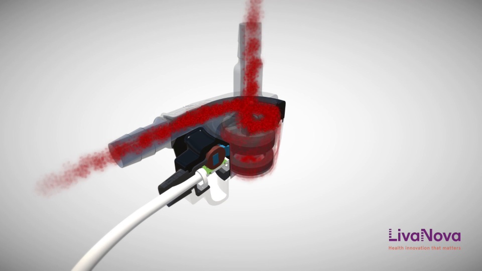 LifeSPARC Pump Dynamics video thumbnail