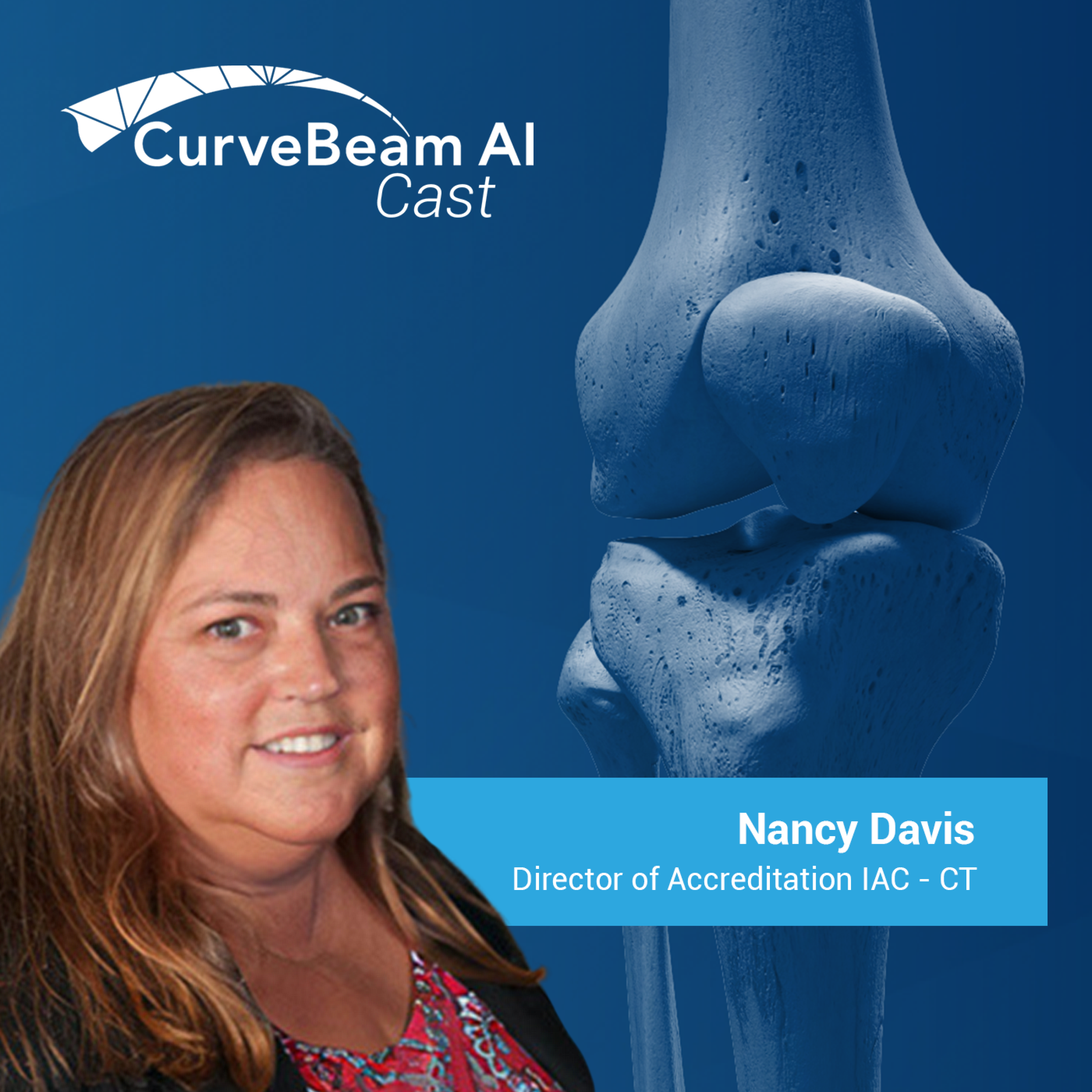 CurveBeam AI Cast