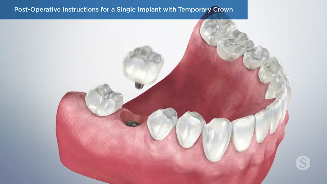 Easy Tips for Cleaning Dentures Effectively Joshua A. Holcomb DDS Blog