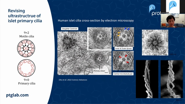 Scanning electron microscopy of human islet cilia