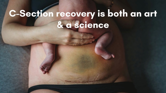 C-Section Recovery - A Practical Guide - Wondercare