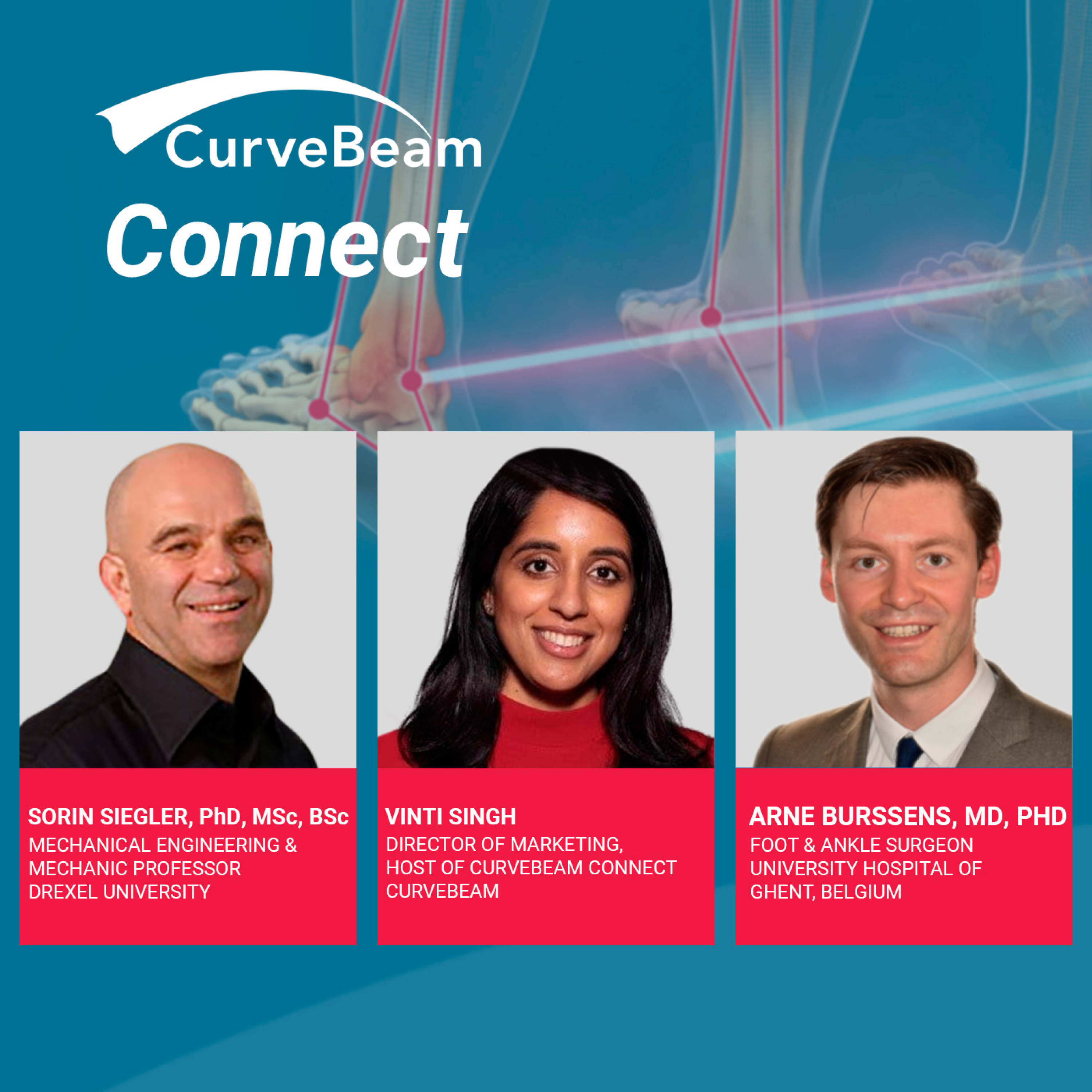 CurveBeam AI Cast