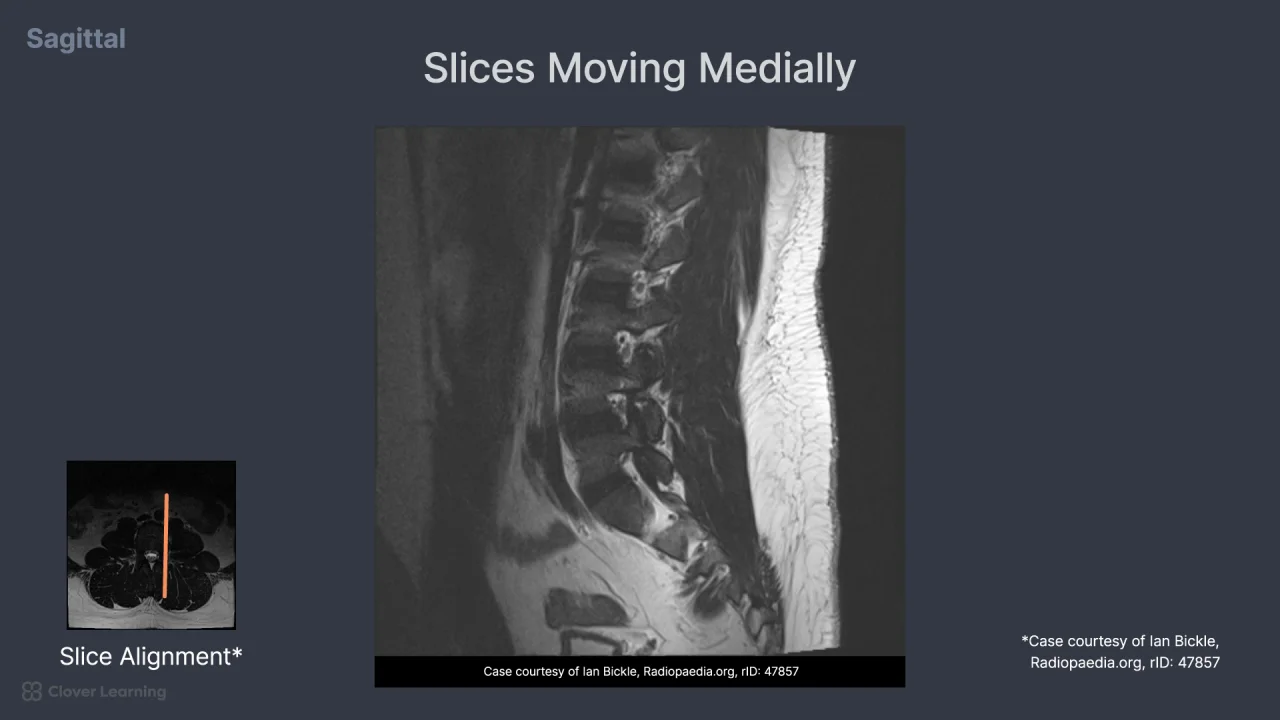 Lumbar Spine Anatomy Mri MRI Spine Anatomy | Free MRI Axial Cervical