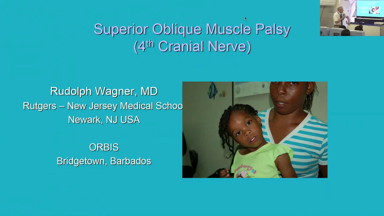 inferior oblique palsy