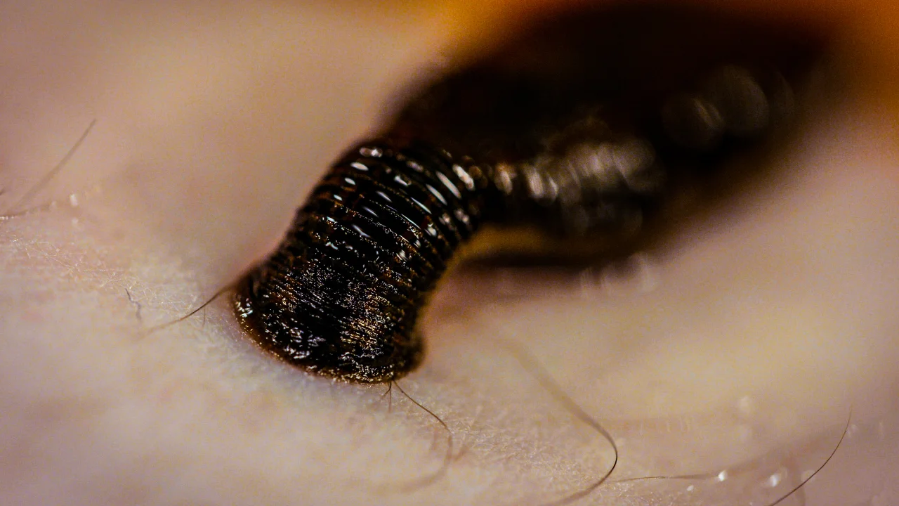 Blood-sucking leeches can help scientists map biodiversity