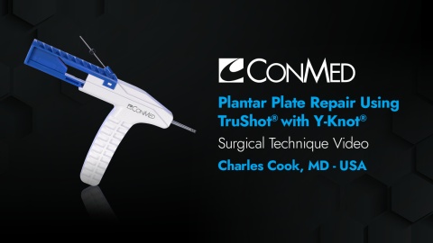Dr. Cook - Plantar Plate Repair Using TruShot® with Y-Knot®