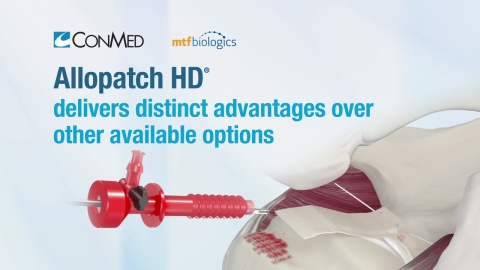 Allopatch HD® - Product Video