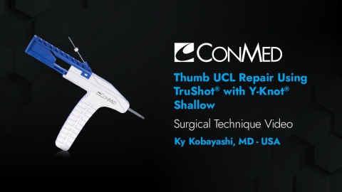 Dr. Kobayashi - Thumb UCL Repair Using TruShot®  with Y-Knot® Shallow