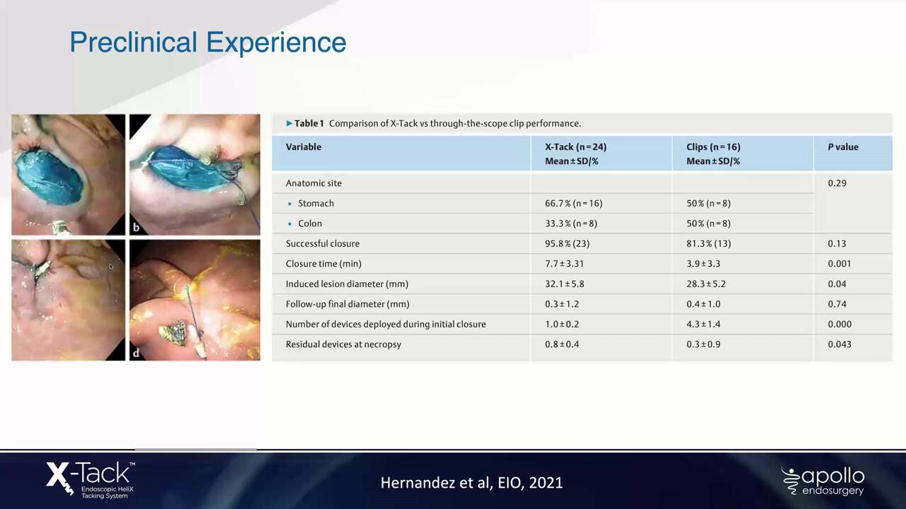 Part 1- X-Tack Overview Webinar_March_MKT-01461-00R01