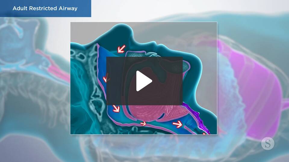 adult restricted airway