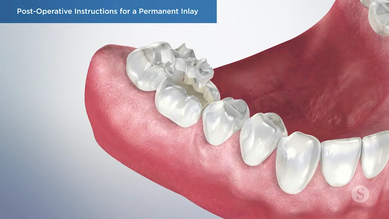 Easy Tips for Cleaning Dentures Effectively Joshua A. Holcomb DDS Blog