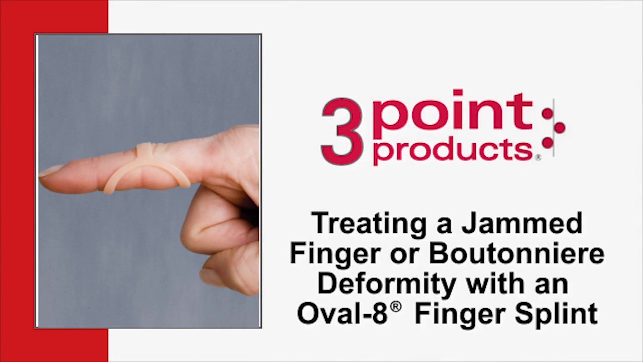 How to Treat Boutonniere Deformity with an Oval-8 Finger Splint
