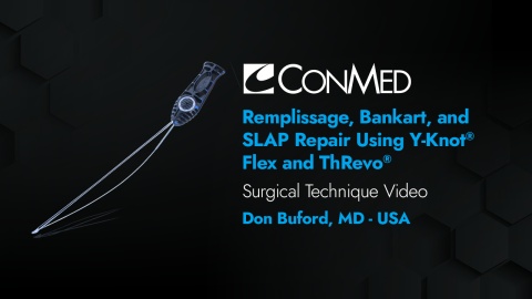 Dr. Buford - Remplissage, Bankart, and SLAP Repair Using Y-Knot® Flex and ThRevo®