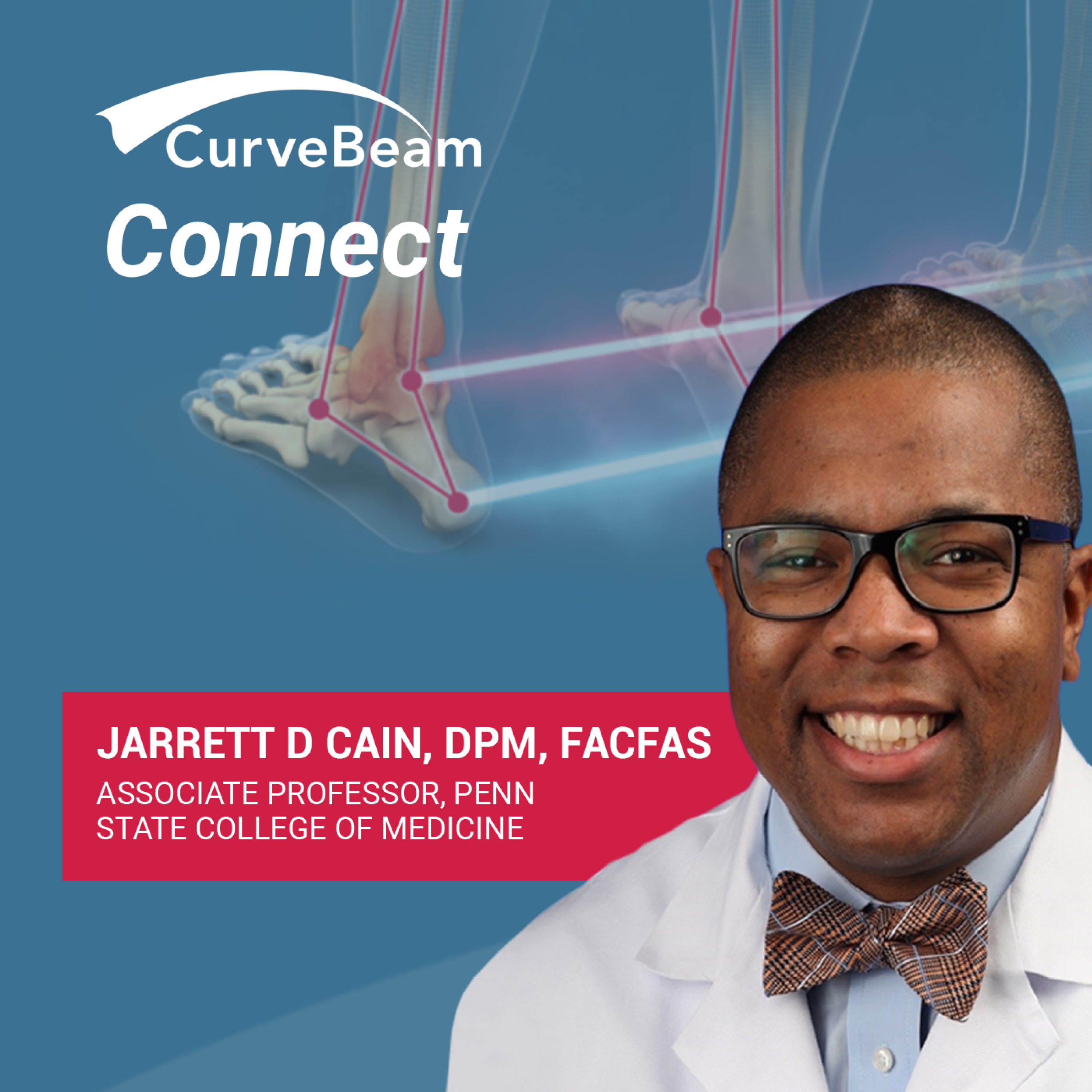 CurveBeam AI Cast