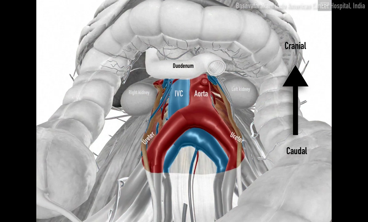 Transperitoneal and Retroperitoneal Port Placement