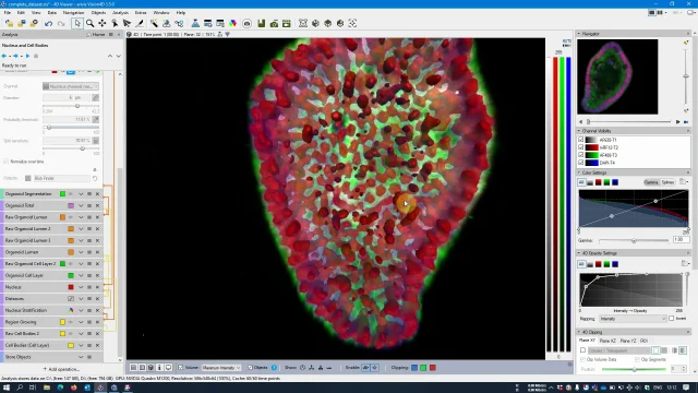 arivis Vision4D - Segmentação de Nucelus e Corpo Celular