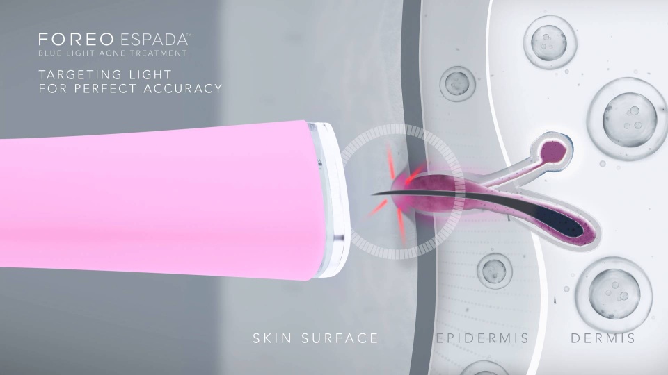 Acne treatment blue light