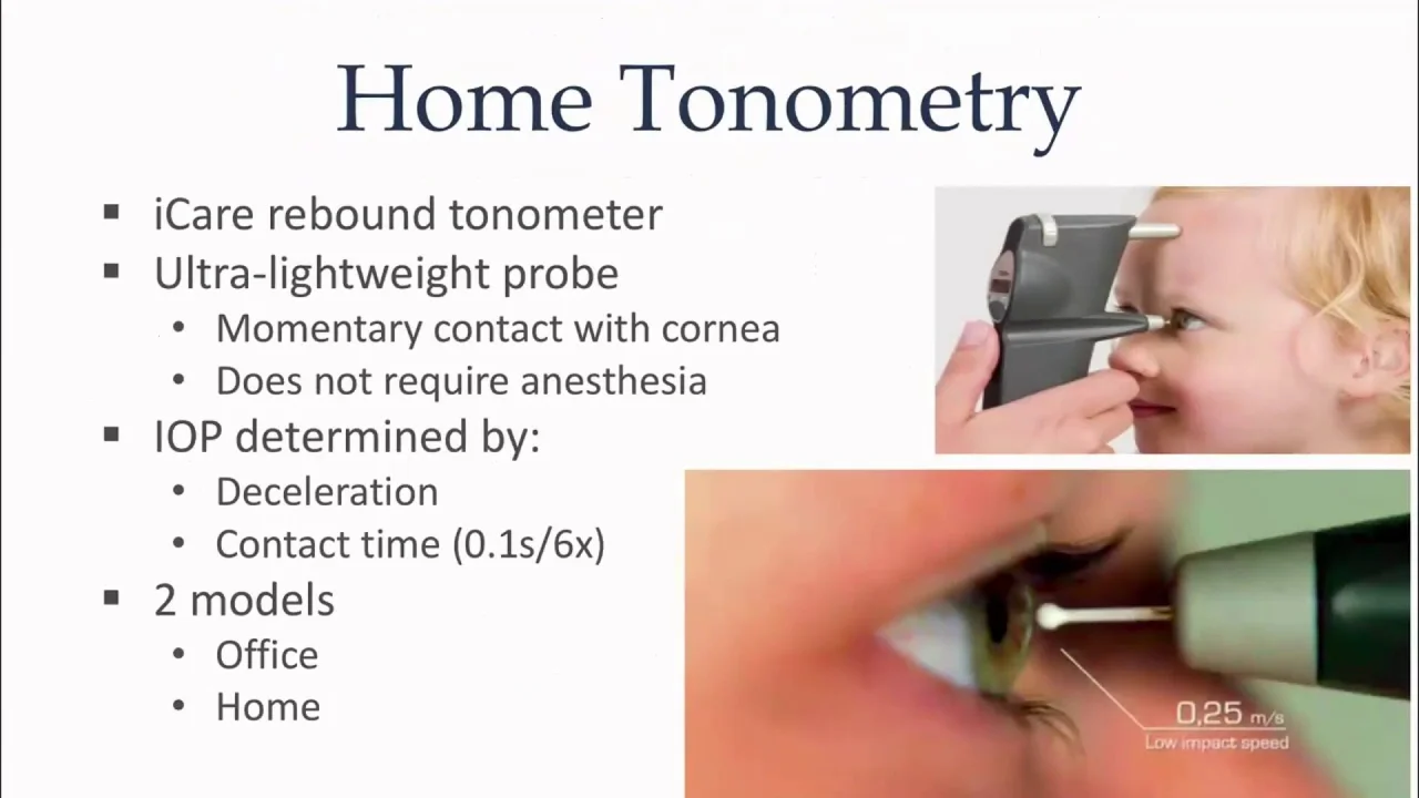 how-to-measure-intraocular-pressure-applanation-tonometry-58-off