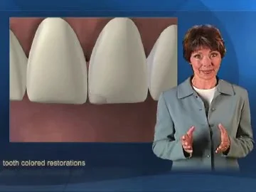 Tooth Filling Lebanon TN | Tooth Filling | Dental Work Lebanon