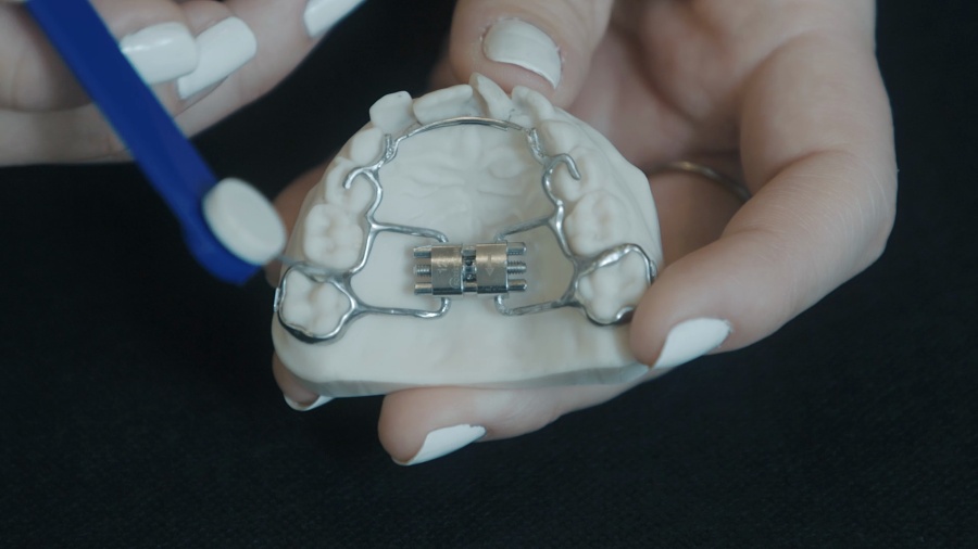 <p>This instructional video demonstrates the proper technique for operating a medical expander device. The content explains that patients should follow their doctor's specific instructions for frequency of turns, emphasizing the importance of daily compliance. The step-by-step process involves using a key to insert into the device's hole, pushing back until the next hole becomes visible, then wiggling the key out to complete one turning cycle.</p>
