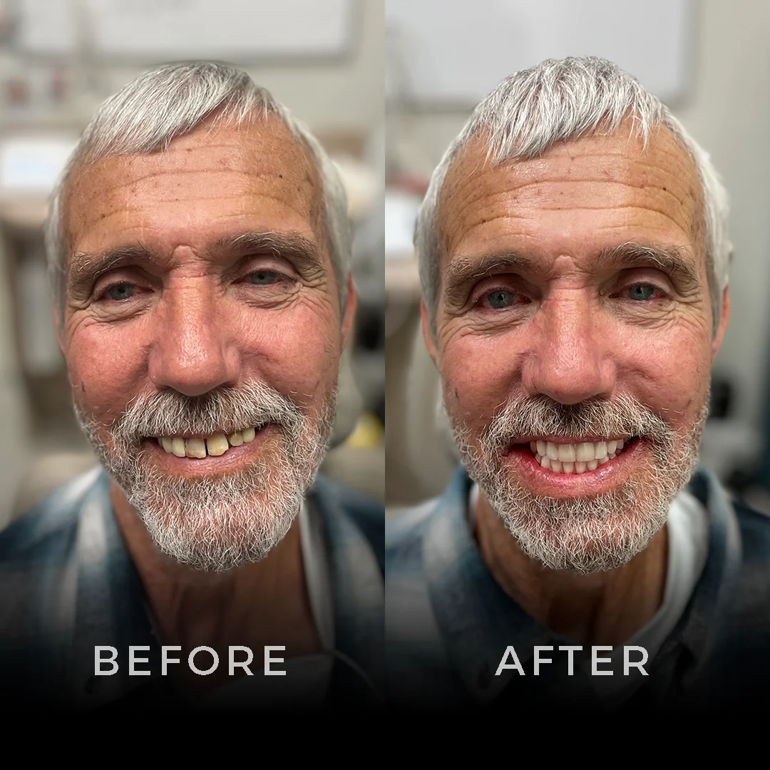 Full Arch Ninja - Home Page