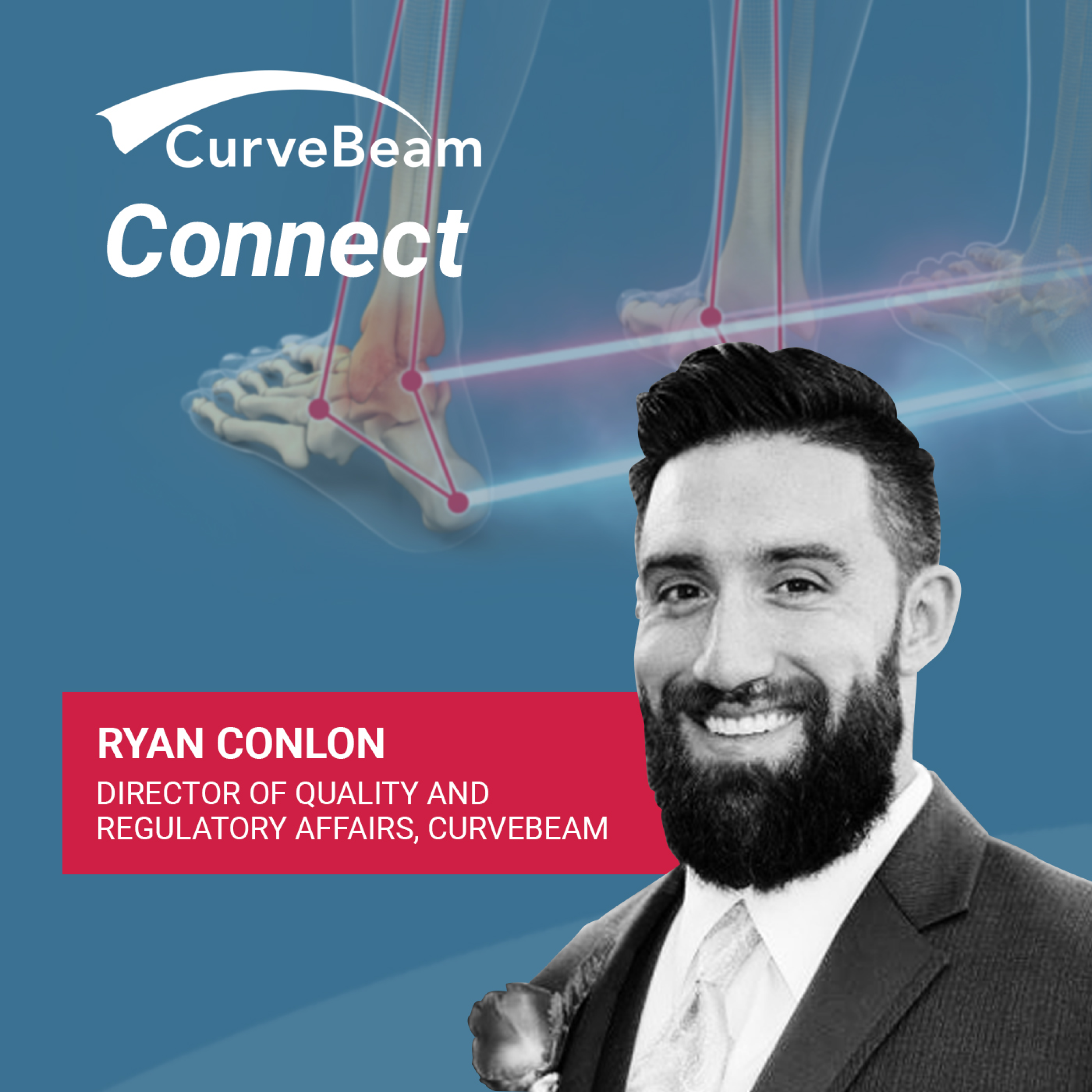 CurveBeam AI Cast
