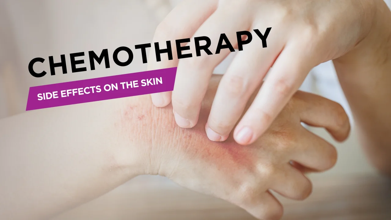 Chemo Side Effects Rash Chemotherapy Side Effect Numbness And Tingling