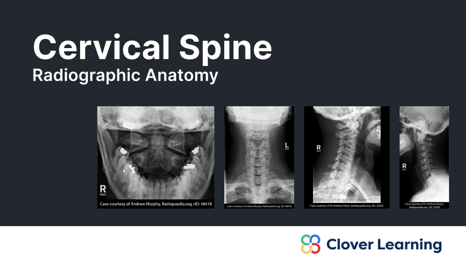 Cervical Spine: Radiographic Anatomy | Video Lesson | Clover Learning