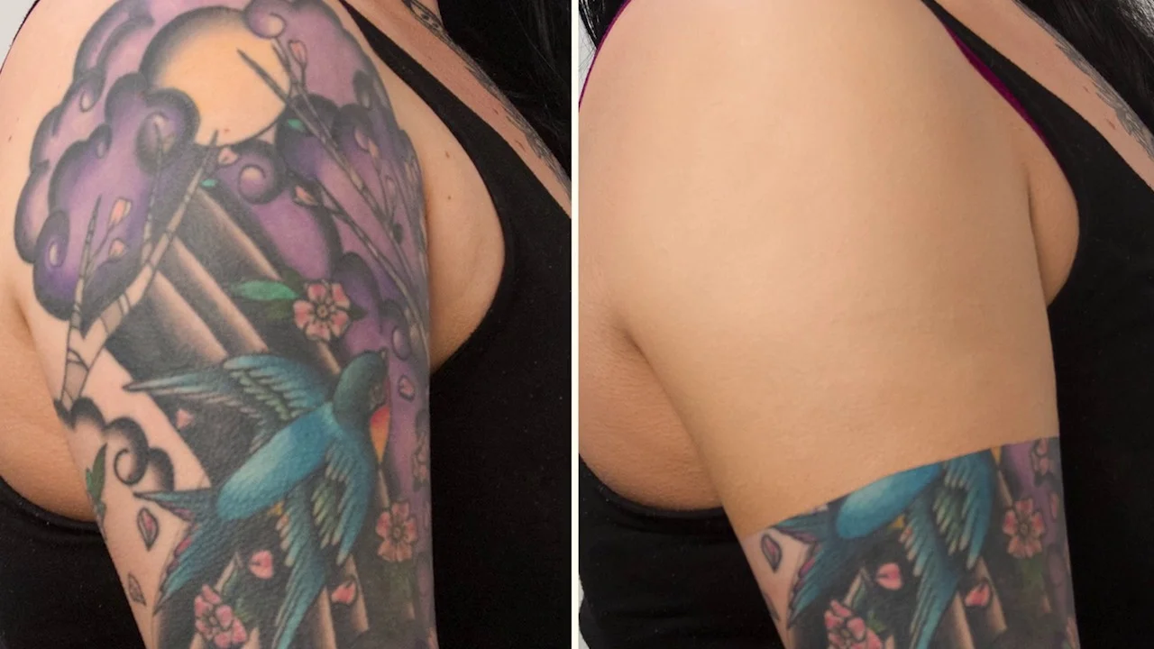 How to CoverUp a Tattoo