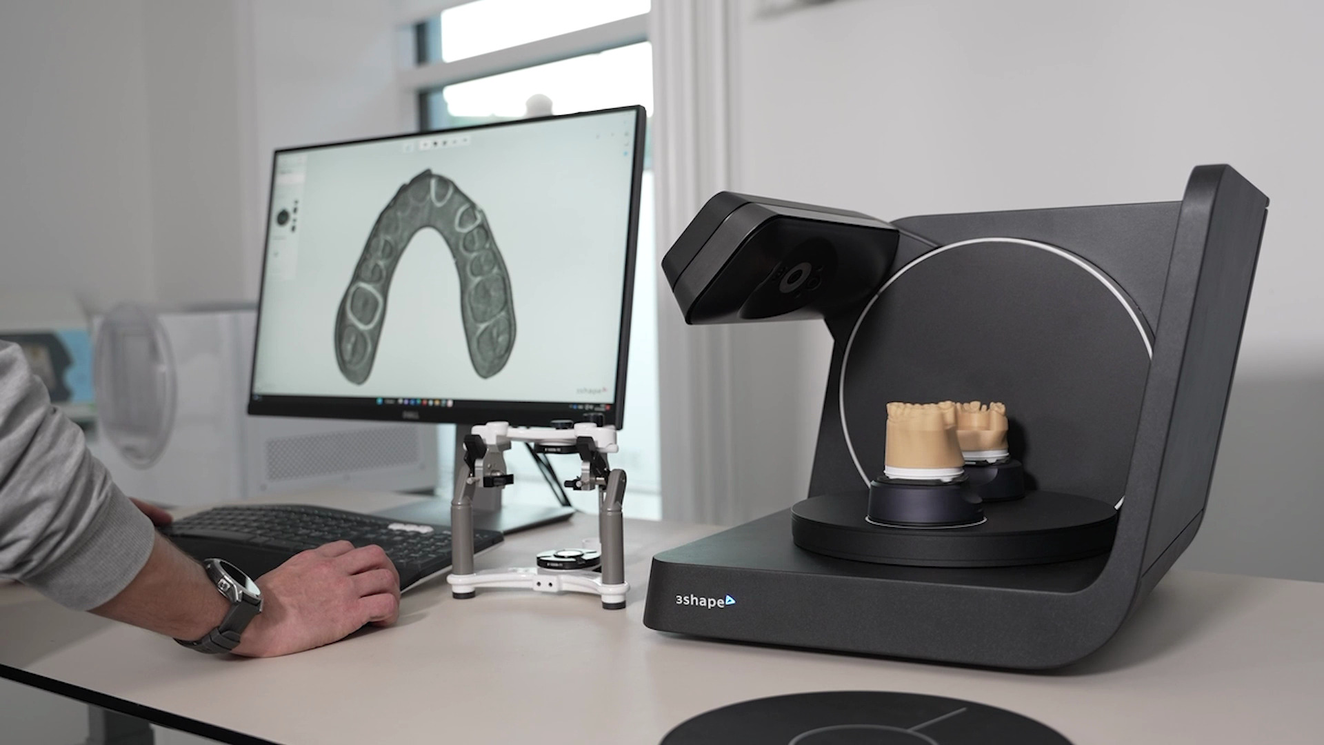 技工所の効率アップを実現するラボスキャナー - 3Shape Blog