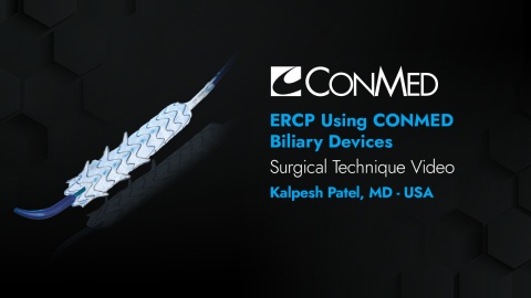 Dr. Patel - ERCP Using the CONMED Biliary Devices