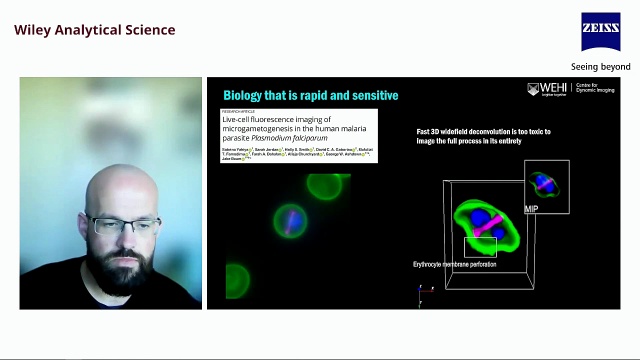 Explore Lattice Lightsheet 7 for Cutting-edge Imaging