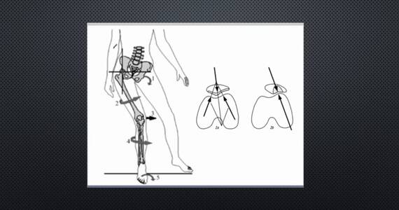 Hip cuff: why is it important
