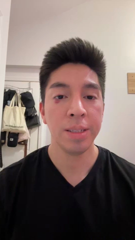 Alvaro video review