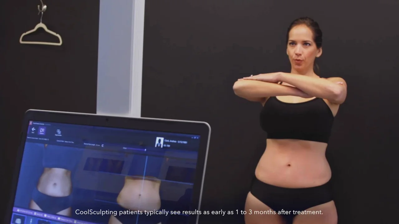 Results to Expect from CoolSculpting Body Contouring Treatment - Just Melt  Med Spa