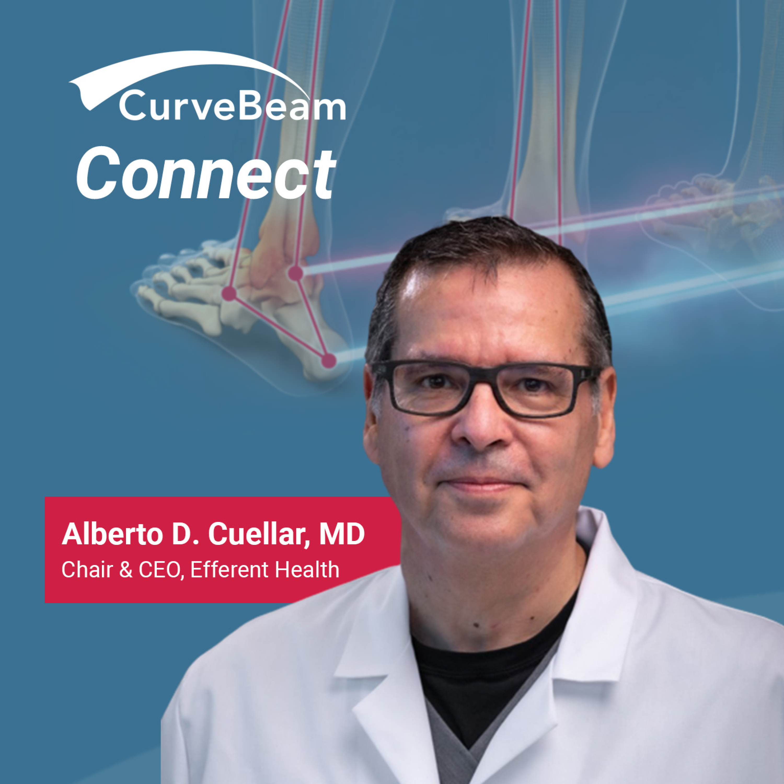 CurveBeam AI Cast