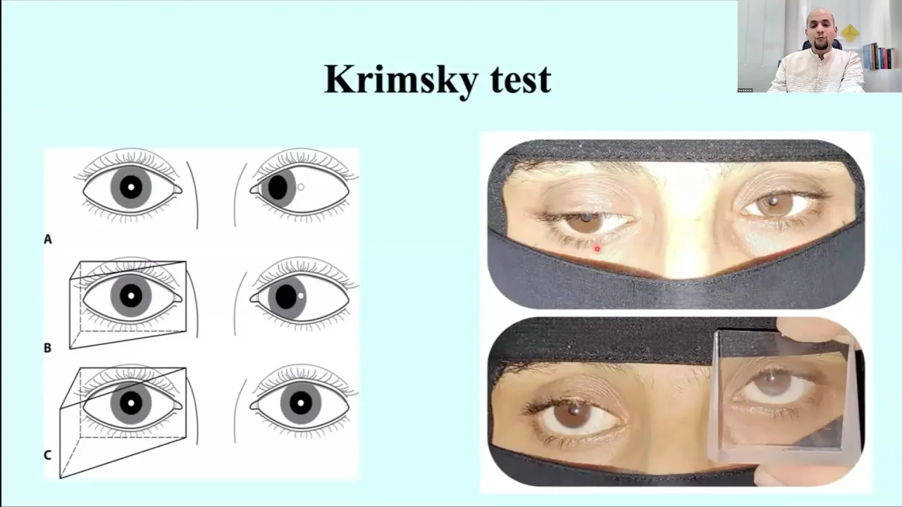 TEXT眼科学 = OPHTHALMOLOGY Ophthalmology: An Illustrated Colour Text: 9780702075025
