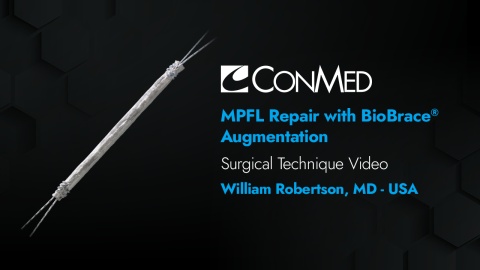MPFL Repair Using BioBrace® Augmentation - Bill Robertson, MD