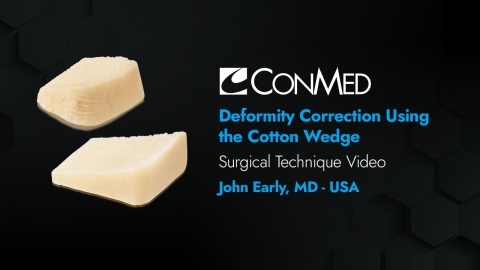 Dr. Early - Deformity Correction Using the Cotton Wedge