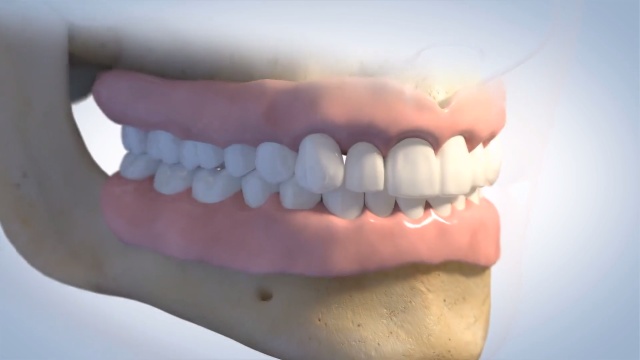 dentures_24fpsNEW