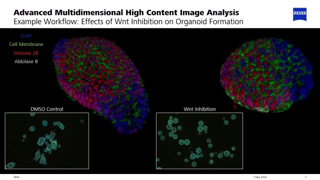 Organoid Workflow 