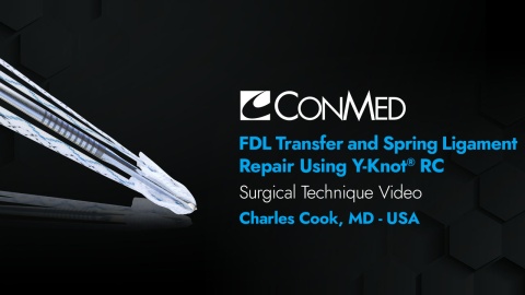 Dr. Cook - FDL Transfer and Spring Ligament Repair Using Y-Knot RC®