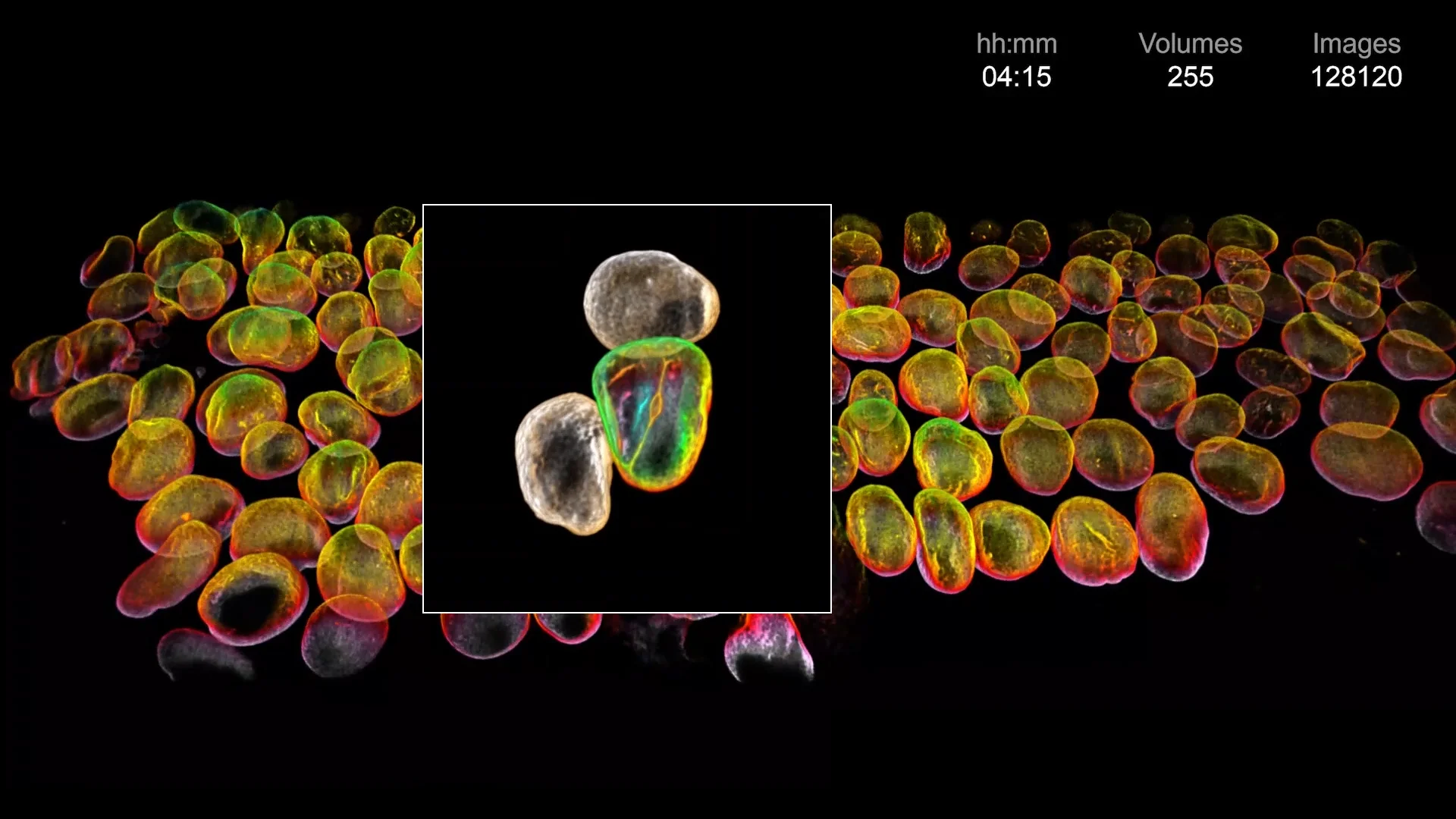 ZEISS Lattice Lightsheet 7 - Human Induced Pluripotent Stem Cells