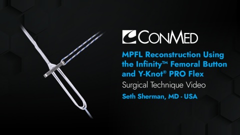 Dr. Sherman - MPFL Reconstruction Using the Infinity™ Femoral Button and Y-Knot® PRO Flex