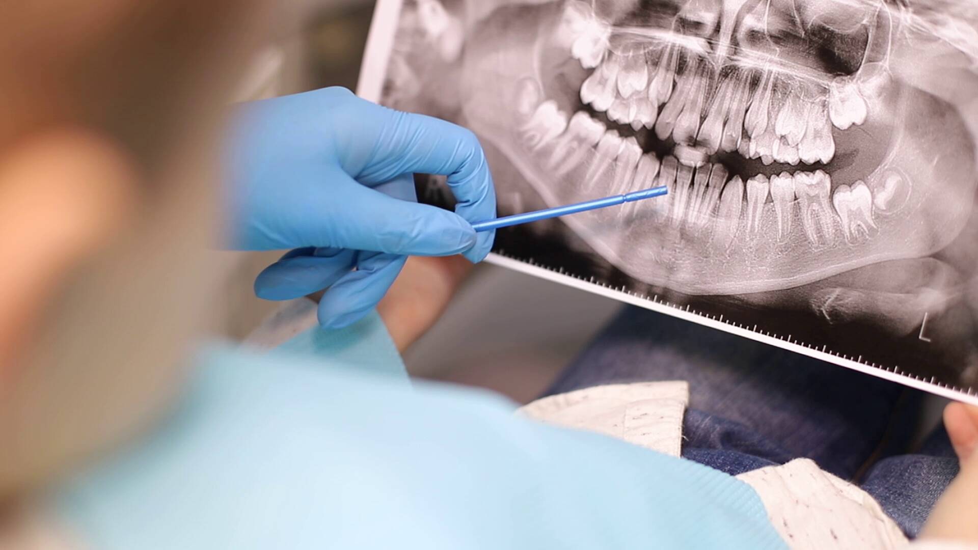 Oral Surgeon La Jolla CA | Top Rated Oral Surgery San Diego