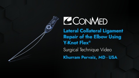 Dr. Pervaiz - Lateral Collateral Ligament Repair of the Elbow Using Y-Knot® Flex