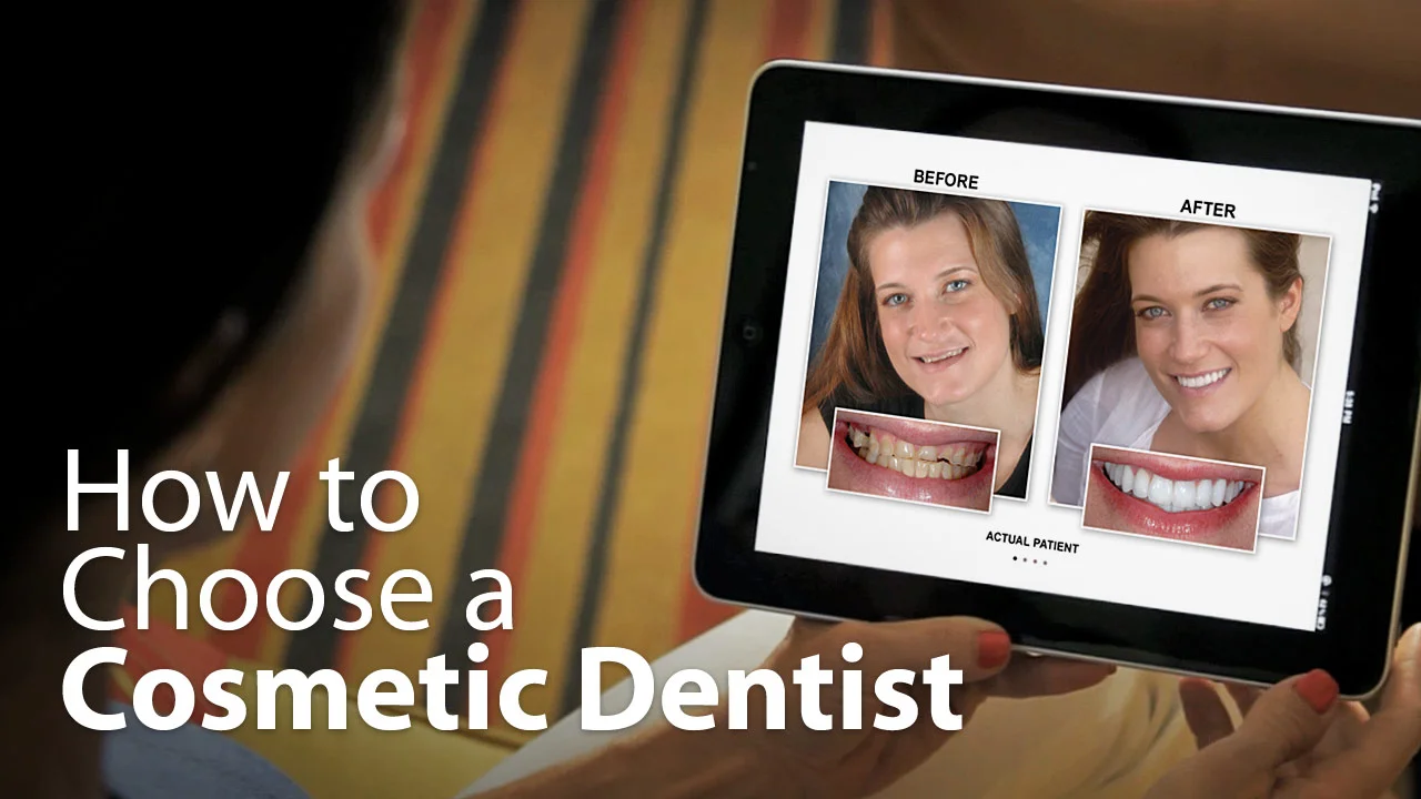 How to Choose a Cosmetic Dentist
