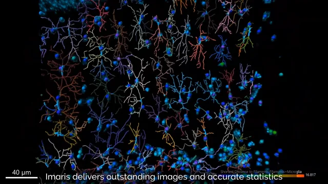 Dragonfly 高速共焦点顕微鏡システム - Andor - オックスフォード